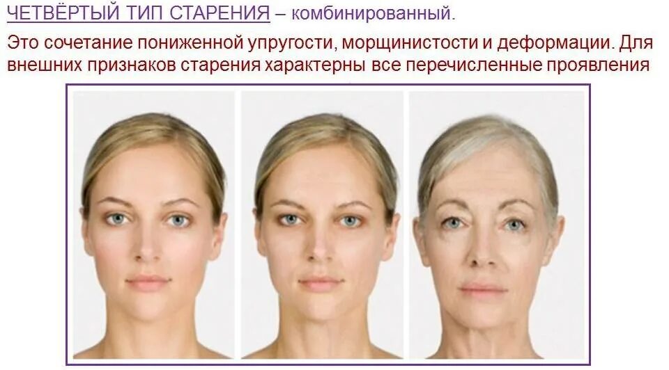 Определить тип старения тест