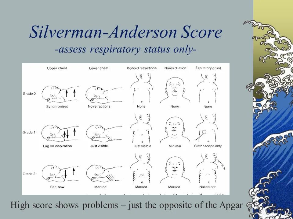 Шкала сильвермана. Шкала Silverman. Silverman-Anderson. Silverman Respiratory score. Оценка по шкале Сильверман у новорожденного.