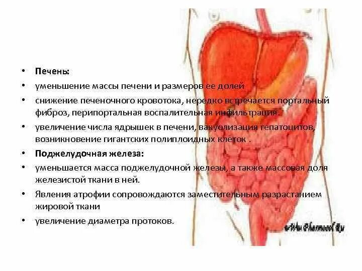 Может ли повысится печени. Уменьшить Размеры печени. Уменьшение размеров печени причины. Сокращение размеров печени. Уменьшение размеров печени встречается.