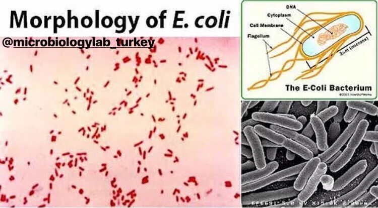 Coli sotwe. Кишечная палочка Escherichia coli. Escherichia coli микробиология морфология. Escherichia coli эшерихии. Escherichia coli гемолитические антибиотики.