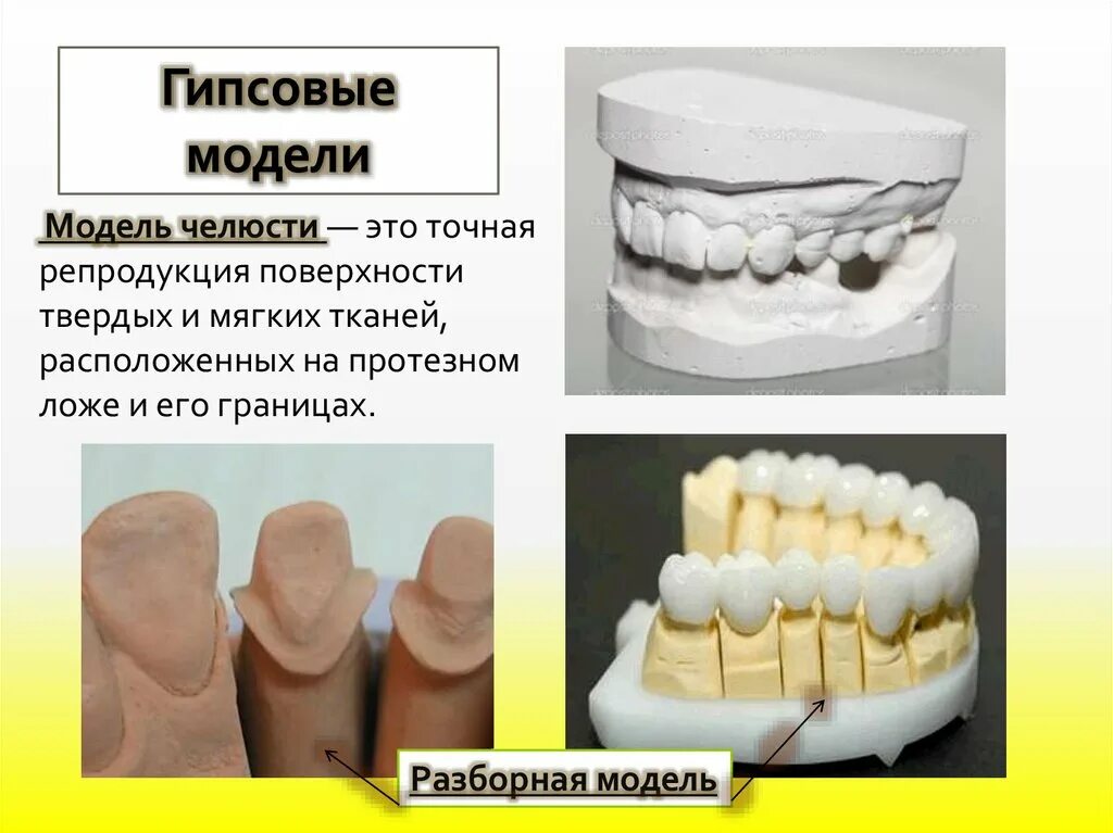 Гипсовые модели челюстей. Гипсовая модель. Разборная гипсовая модель. Разборные модели челюстей.