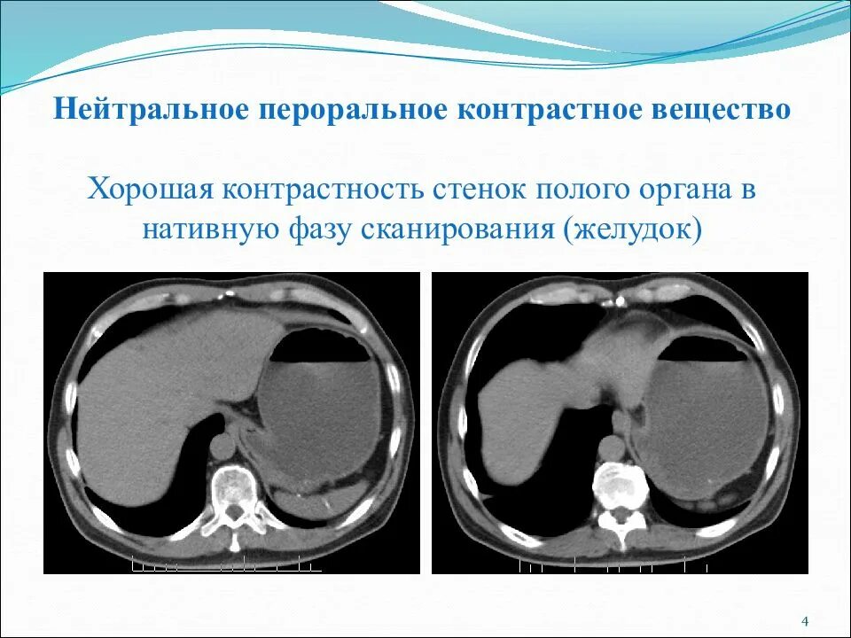 Плохо после контраста кт. Контрастное вещество при кт. введение контрастного вещества при кт. введение контраста при кт. вещество для контраста при кт.