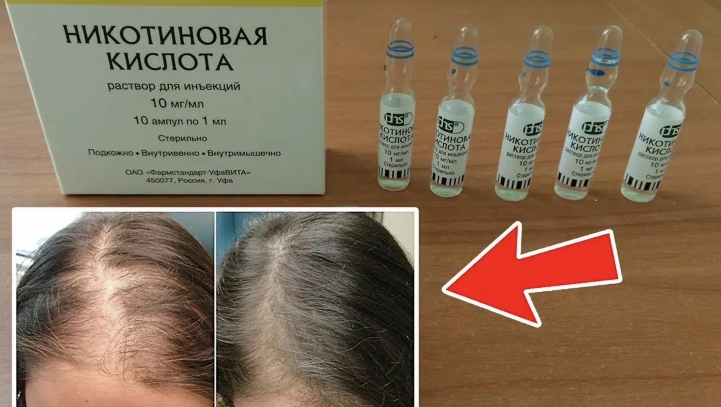 Как использовать никотиновую кислоту
