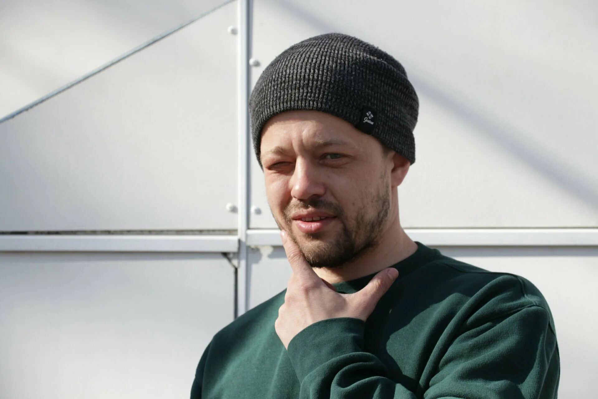 Житковский алексей до и после пластики Жидковский в школе 85 фото