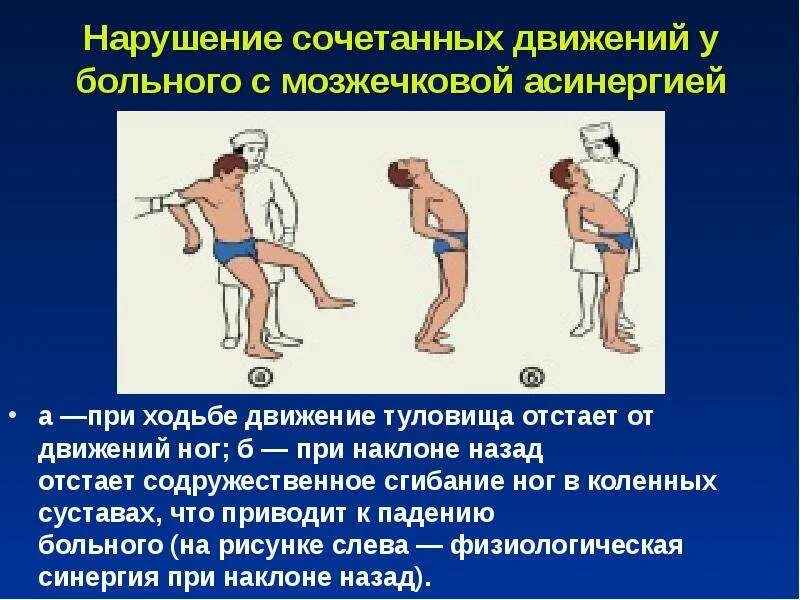 Движение туловища. Нарушение походки при поражении мозжечка. Походка при поражении мозжечка. Нарушение движения. Содружественные движения в конечностях.