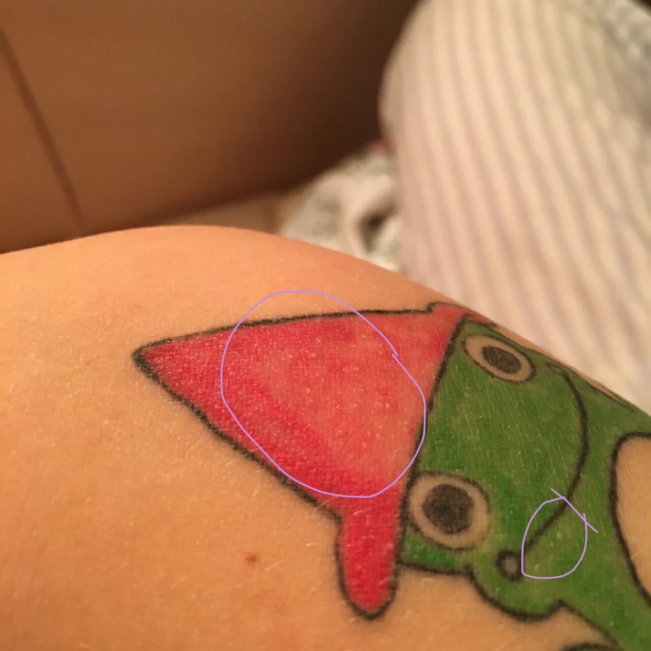 Тату на прыщах можно ли. Тату на прыщах можно ли. Маленькие пупырышки на татуировке. Тату на прыщах можно ли. Тату на прыщах можно ли.