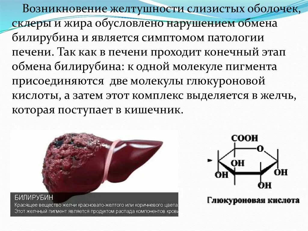 Крови печень как определить. Билирубин и глюкуроновая кислота. Экспериментальное моделирование патологии печени. Выделяемые вещества печени. Билирубин в печени как выглядит.