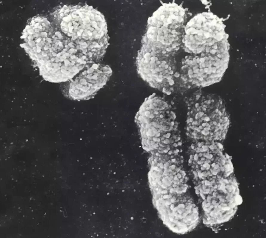 Вторая х хромосома. Х И У хромосомы под микроскопом. Игрек хромосома. Игрек хромосома под микроскопом. Y хромосома.
