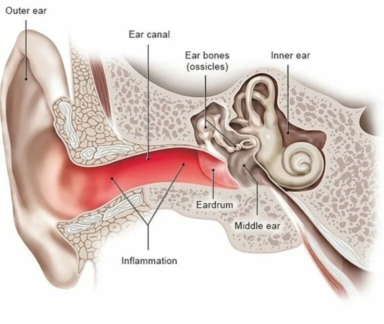 Режет слух синоним