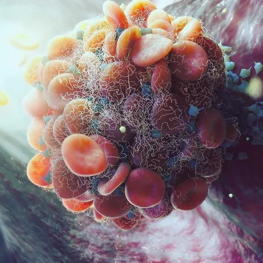 гной под микроскопом