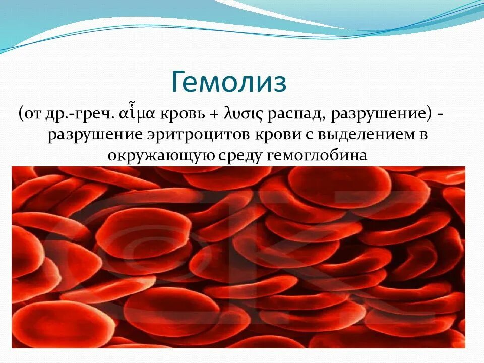 Гемолиз эритроцитов в крови. Гемолиз эритроцитов лаковая кровь. Признак гемолизированной крови плазма. Гемолизированные эритроциты гистология.