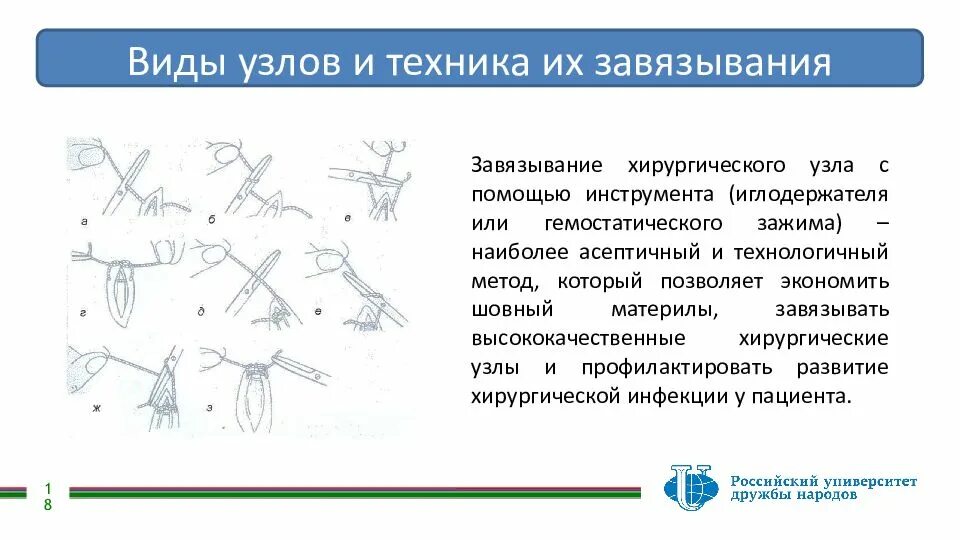 Как делать хирургический узел Как завязать простой хирургический узел: виды и способы образования, классически