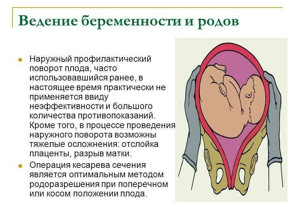 Позиция плода при поперечном положении. Поперечное и косое положение плода тактика. Методы диагностики поперечного положения плода.. Частые осложнения поперечного положения плода:. Поперечное положение плода при беременности.