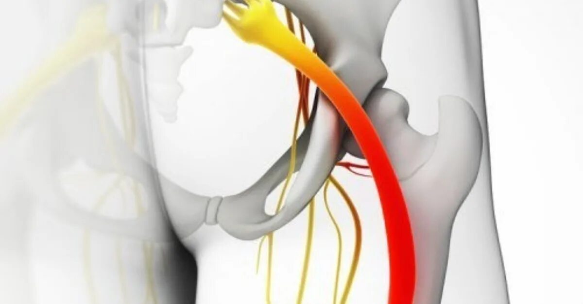 Сильно болит крестец. Простреливающая боль в крестце.