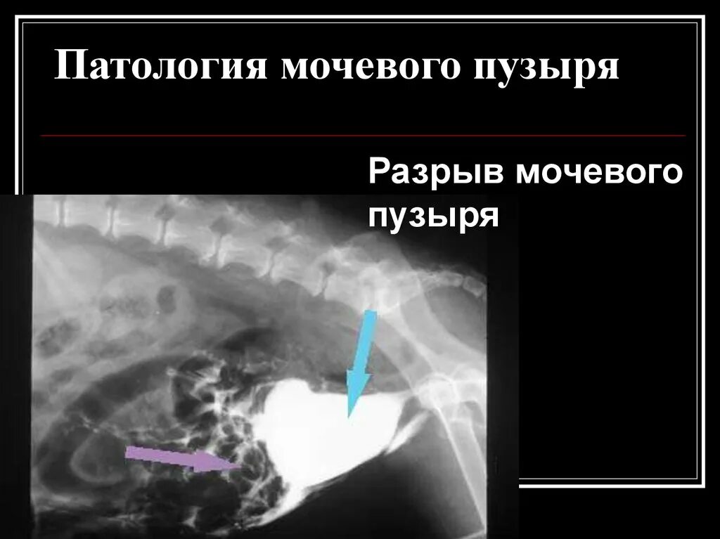 Аномалия мочевого. Патология мочевого пузыря. Патология мочевого пузыря презентация. Рентген презентация. Контрастная рентгенография кратко.