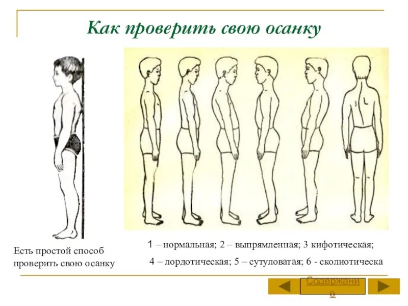 Проверьте правильно ли. Как определить осанку. Как проверить свою осанку. Правильность осанки. Как определить осанку в домашних условиях.