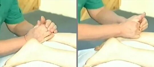 пяточная шпора у детей фото. пяточная шпора массаж видео. массаж при пяточном фасците. массаж при пяточной шпоры. массаж ног.