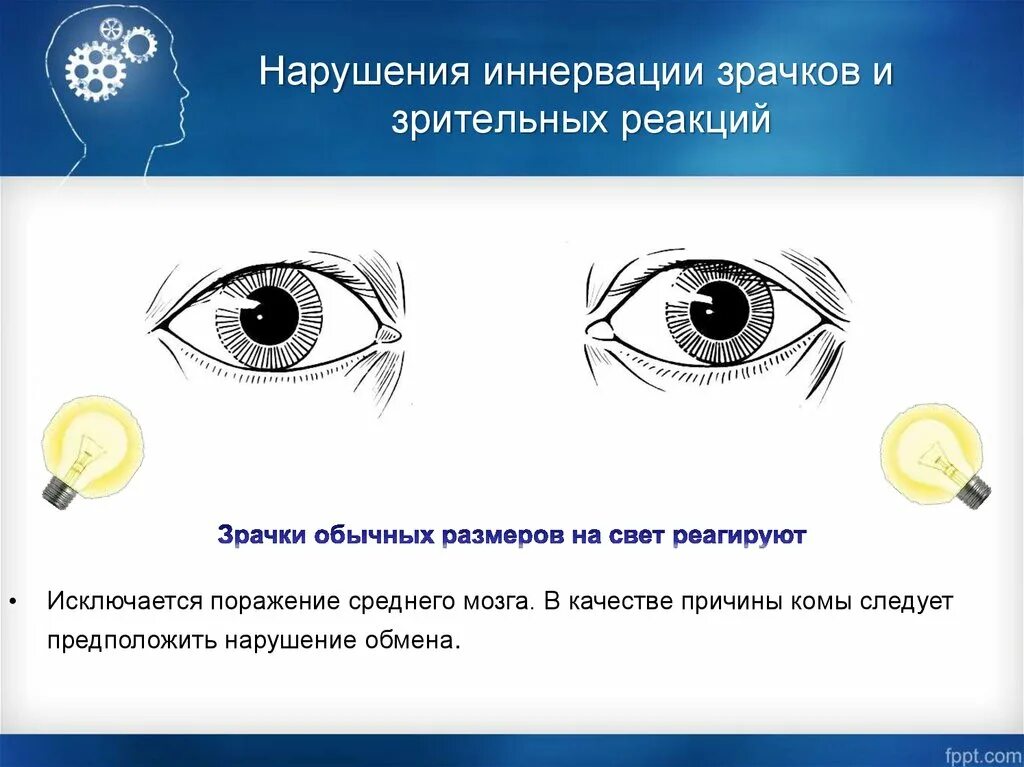 Оценка реакции зрачков на свет при нарушении сознания. Нарушение зрачковых реакций. Исследование реакции зрачков на свет. Нарушение реакции зрачков. Отсутствие реакции зрачка на свет признак отсутствия