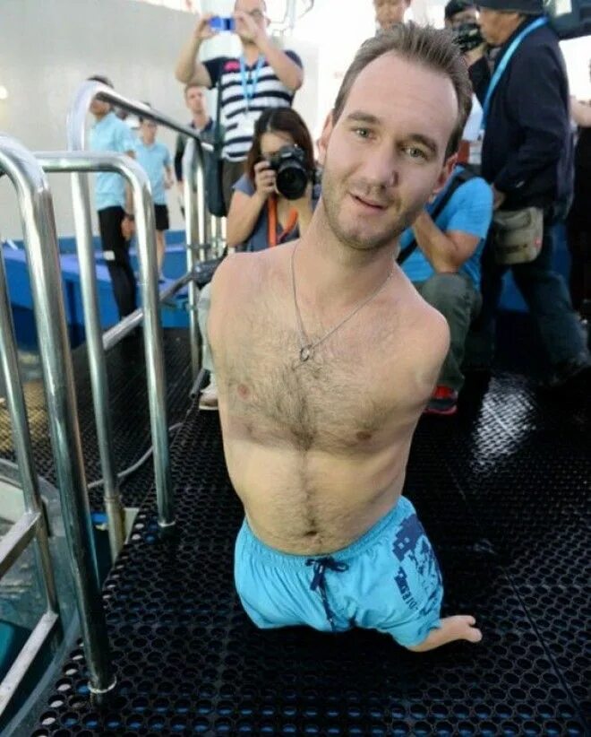 человек без конечностей ник вуйчич. без рук и без ног ник вуйчич. тетраамелия ник вуйчич. без рук и ног ник вуйчич. чел без рук и ног.