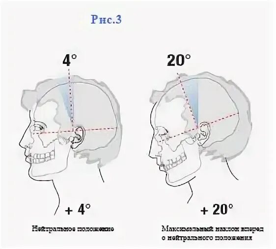 Наклоненный лоб. Наклон лба. Угол наклона головы. Наклон положение лба. Угол наклона лба.