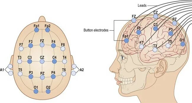 Система ээг. Схема расположения электродов 10-20 ЭЭГ. Схема наложения электродов при ЭЭГ 10-20. Схема наложения электродов при ЭЭГ. Правильное наложение электродов при ЭЭГ.