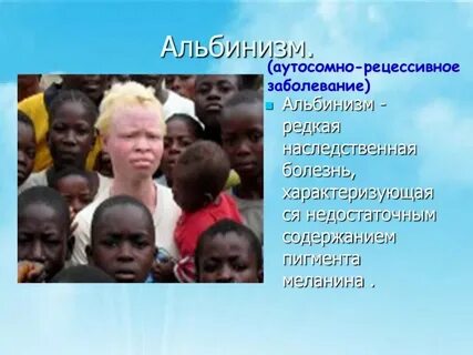 Врожденные и наследственные заболевания 8 класс биология