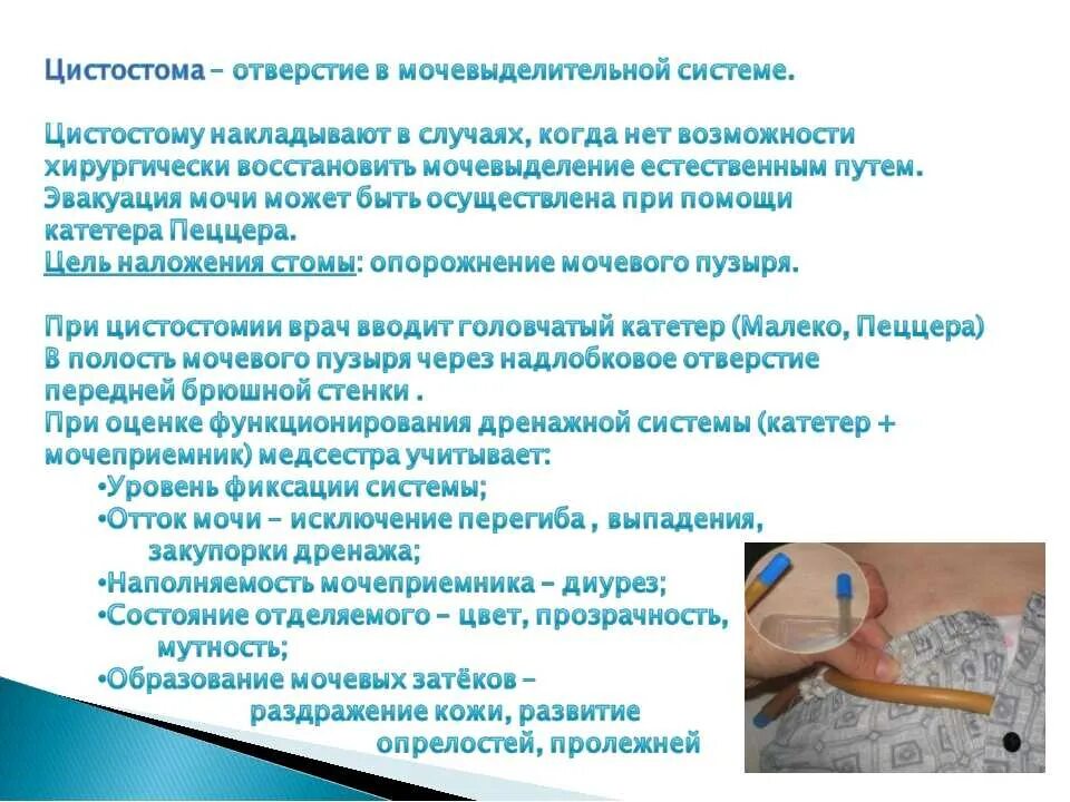 Тренировка мочевого пузыря при цистостоме. Промывание катетера мочевого пузыря алгоритм. Осложнения цистостомии.