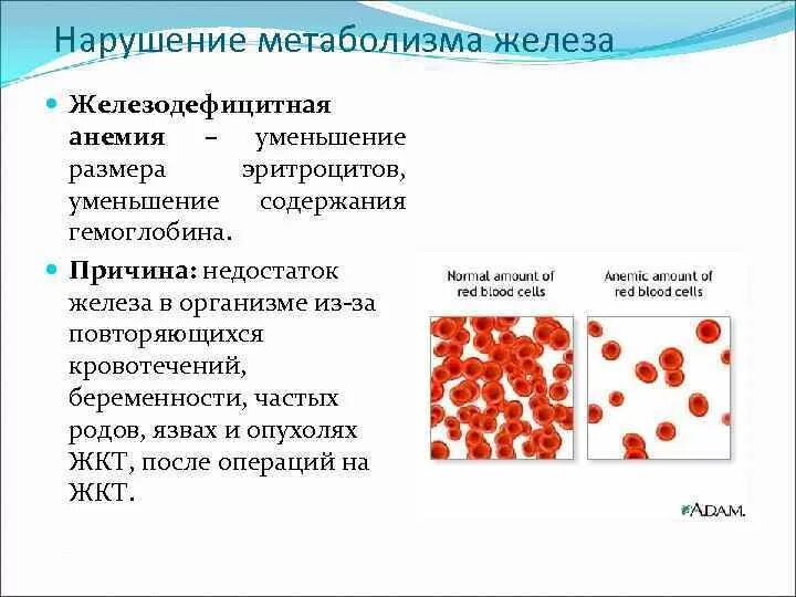 Анемия биохимия. Железодефицитная анемия биохимия причины. Биохимия нарушение обмена железа. Нарушения обмена железа: железодефицитная анемия. Причины дефицита железа железодефицитной анемии.