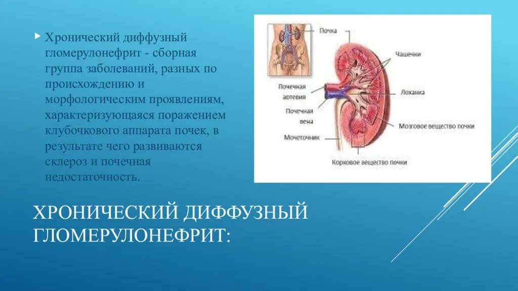 Мочевыделительная система при гломерулонефрите. Патология мочевыводящей системы- гломерулонефриты. Заболевание почек гломерулонефрит. Мочевыделительной системы у детей. Хронический диффузный гломерулонефрит