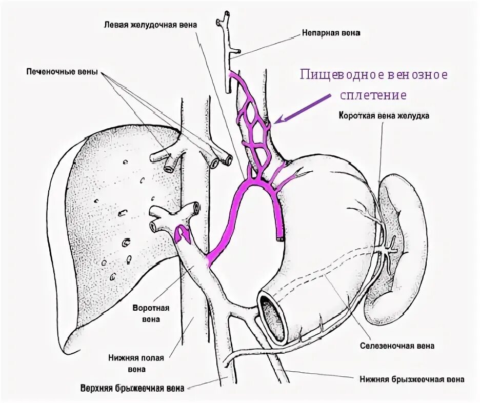 Портокавальный анастомоз пищевода. Портокавальные анастомозы схема. Портокавальный анастомоз желудка. Анастомозы вен анатомия.