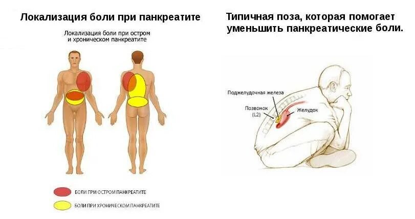 Как питаться после приступа панкреатита