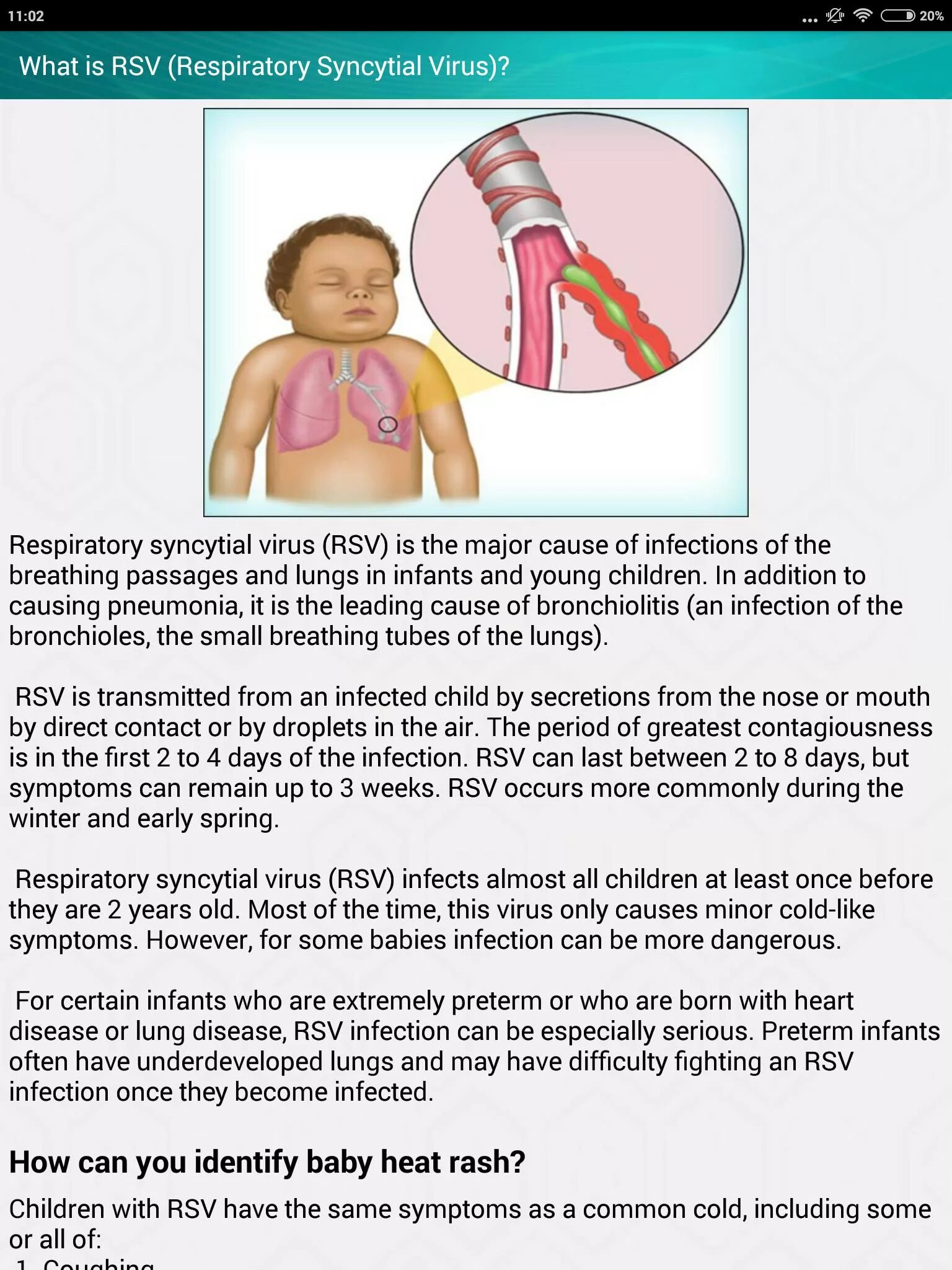 Respiratory virus. РСВ вирус у ребенка.