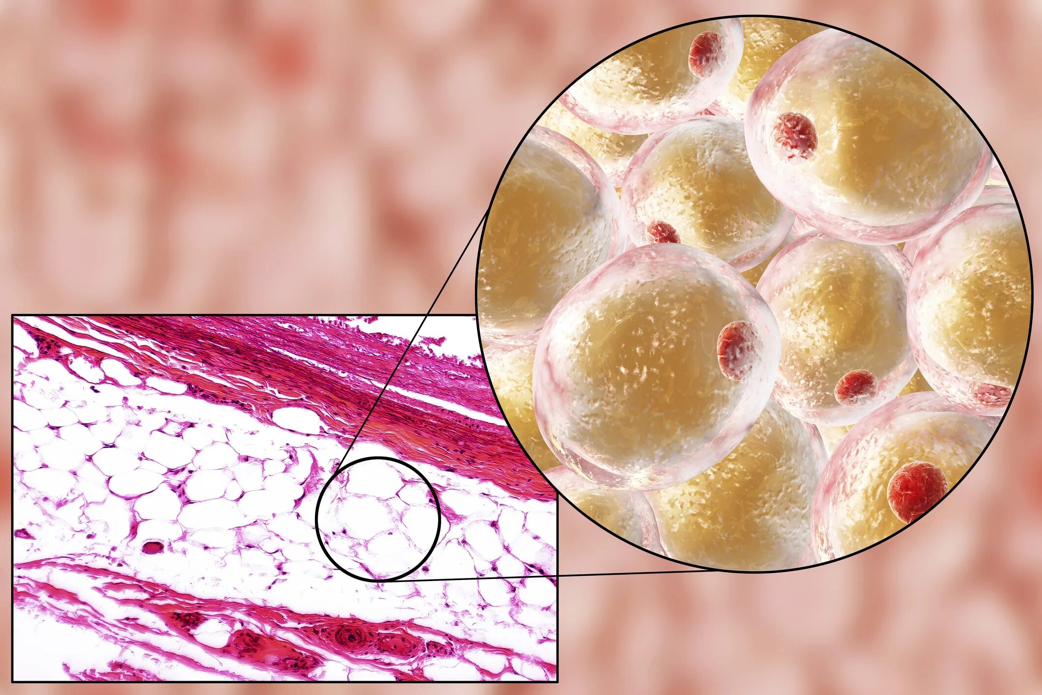 Липоциты. Адипоциты гистология. Белая жировая ткань адипоциты. Жировая ткань микрофотография. Липоциты в жировой ткани.