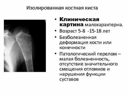 Клинические рекомендации патологический перелом