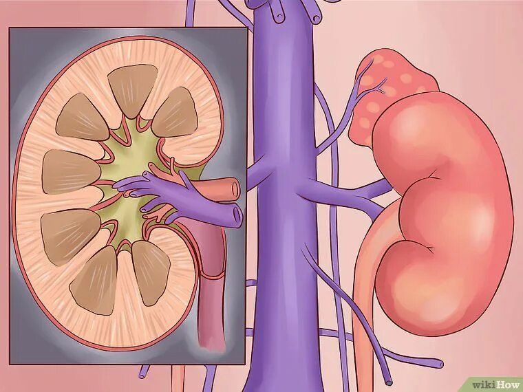 Резекция почки что это. Бляшка рандала анатомия почки. Почки картинка.