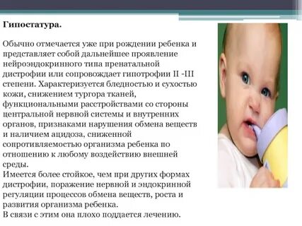 Гипостатура это