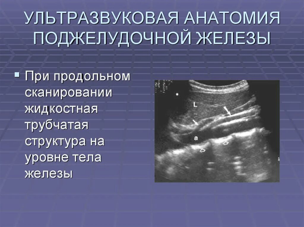 Норма узи поджелудочной железы у мужчин. Ультрасонография поджелудочной железы. УЗИ анатомия поджелудочной железы. Ультразвуковая анатомия поджелудочной железы. Ультразвуковое исследование поджелудочной железы.