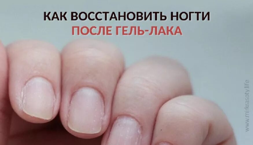 Быстро восстановить ногти после геля. Восстановление ногтей после гель лака. Слоятся ногти после гель лака.