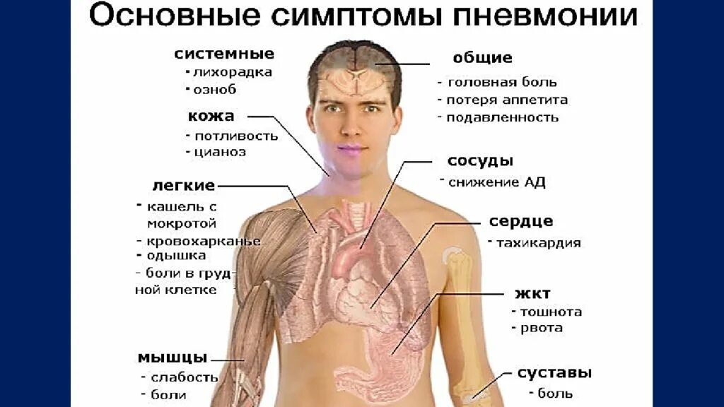 Болезни легких у мужчин. Основные симптомы при пневмонии. Воспаление лёгких симптомы. Восполении лёгких, симптомы.
