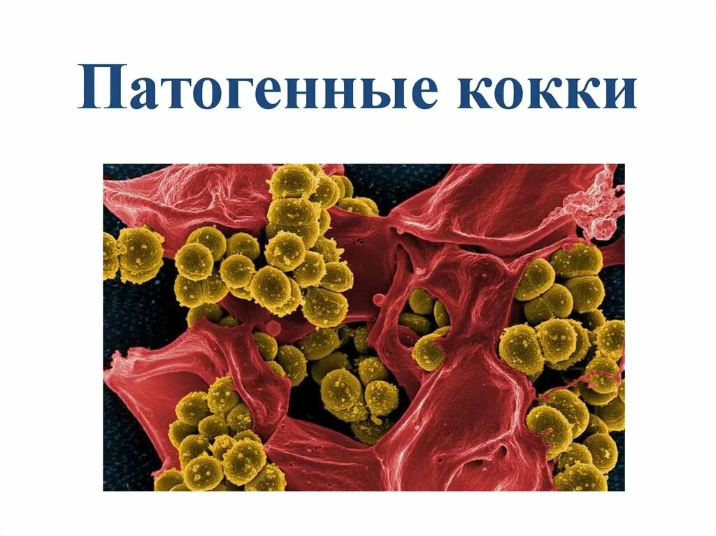 Патогенные кокки. Общие признаки патогенных кокков. Классификация патогенных кокков. Патогенные кокки. Возбудители раневых и гнойных инфекций.