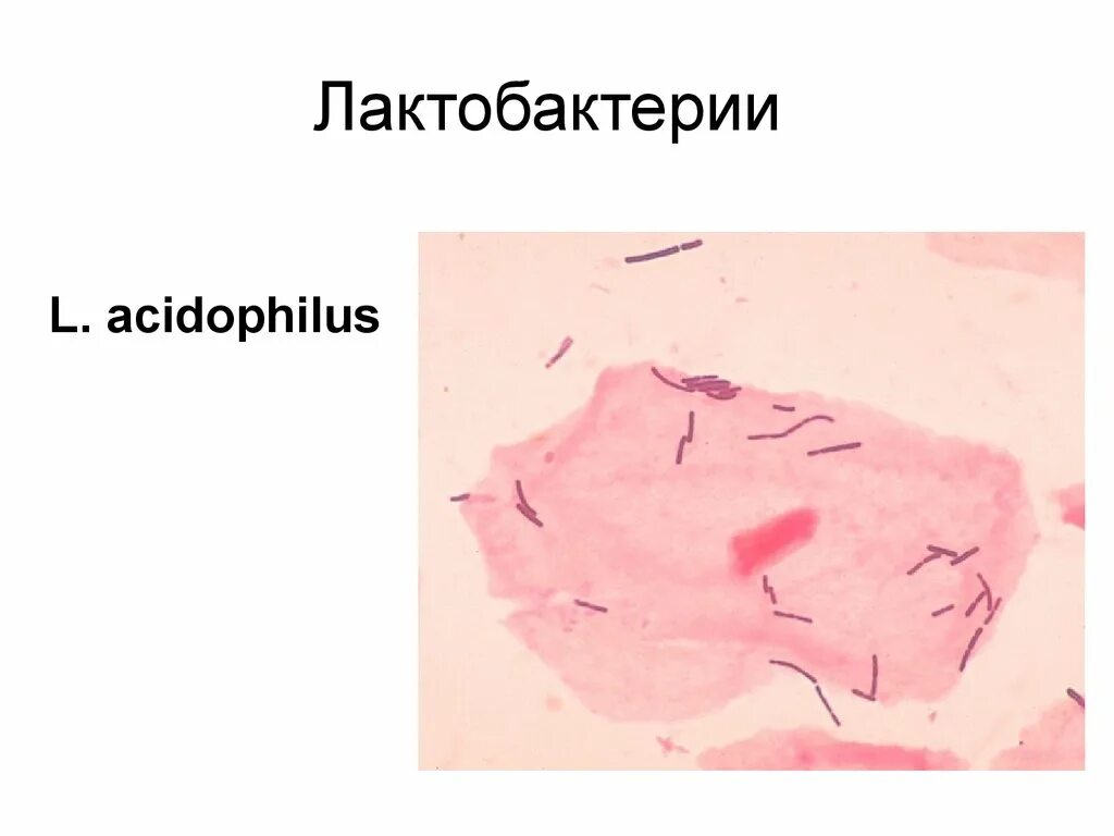 Дефицит лактобактерий. Строение лактобактерий. строение лактобактерии. дисбактериоз микроскопия. лактобактерии в дисбактериозе.