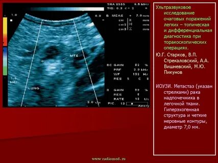 Где сделать узи легких