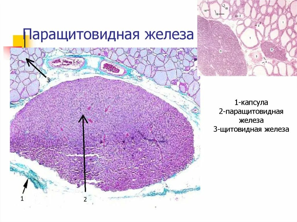 Паращитовидная железа гистология препарат. Околощитовидная железа гистология препарат. Строение околощитовидной железы гистология. Строение паращитовидной железы гистология.