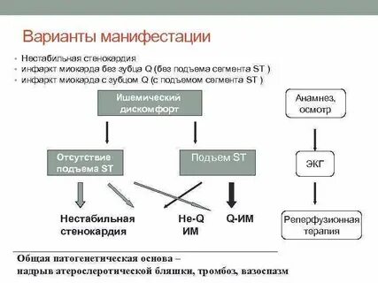 Инфаркт миокарда без подъема сегмента