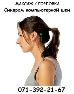 Компьютерная шея