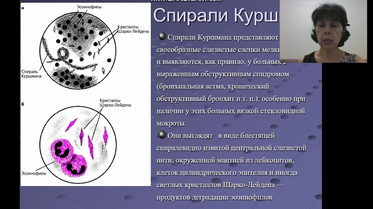 Спирали Куршмана и Кристаллы Шарко-Лейдена. Спирали Куршмана и Кристаллы Шарко-Лейдена в мокроте. Спирали Куршмана, Кристаллы Шарко-Лейдена бронхиальной астме. Спирали Куршмана, Кристаллы Шарко-Лейдена, эозинофилы.