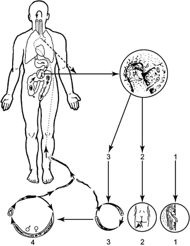 Угрица кишечная жизненный цикл. Стронгилоидоз жизненный цикл схема. Жизненный цикл стронгилоиды.