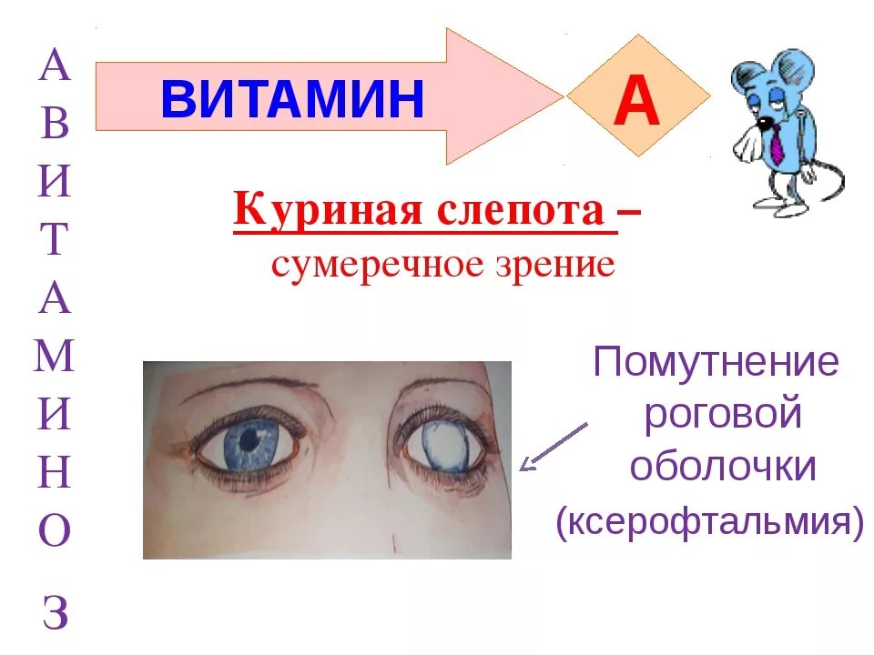 Куриная слепота витамин. Куриная слепота болезнь. Куриная слепота (дефицит витамина а). Куриная слепота недостаток какого витамина.