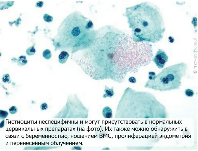 Макрофаги это клетки. Макрофаг микроскоп. Венерическая саркома цитология. Макрофаги цитология. Гистиоциты цветы.
