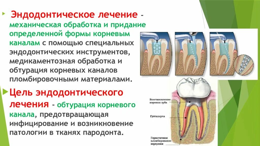 Эндодонтия корневых каналов этапы. Методы и этапы эндодонтического лечения пульпита. Этапы эндодонтического лечения корневых каналов. Инструментальная обработка корневых каналов. Этапы эндодонтического лечения